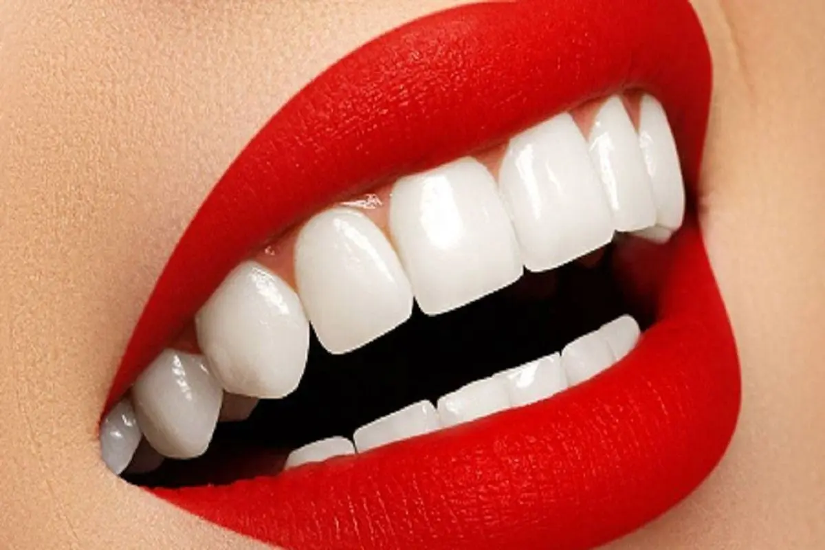 سفید کردن دندان با روش های خانگی