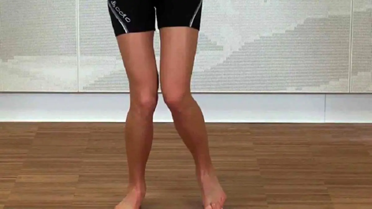 روش اصلاح انحراف زانو+فیلم