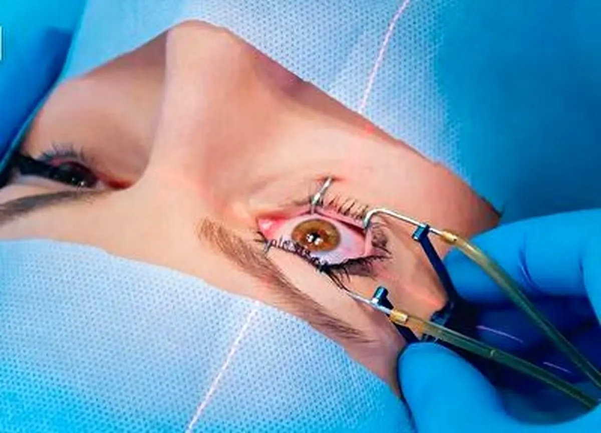 برای اولین بار در تاریخ صداوسیما؛ جراحی چشم روی آنتن تلویزیون