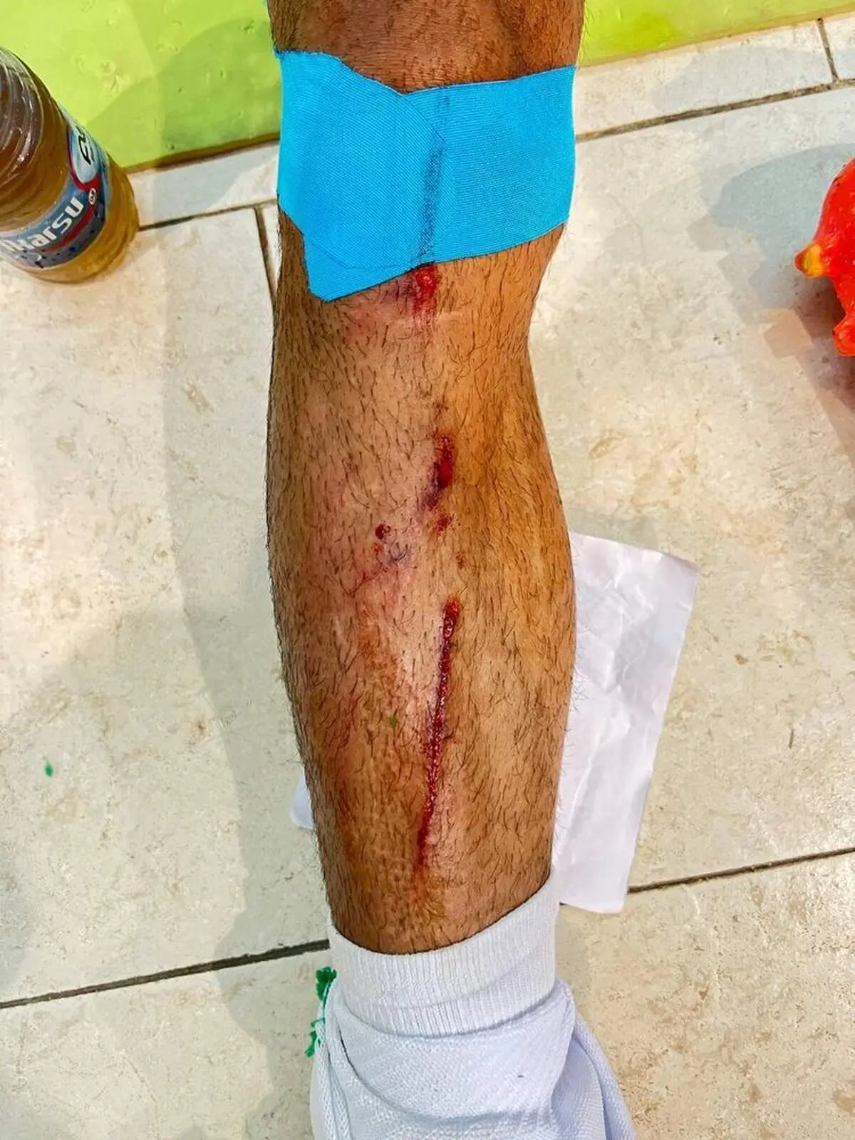 بلایی که بیرانوند سر بازیکن استقلالی آورد+ عکس