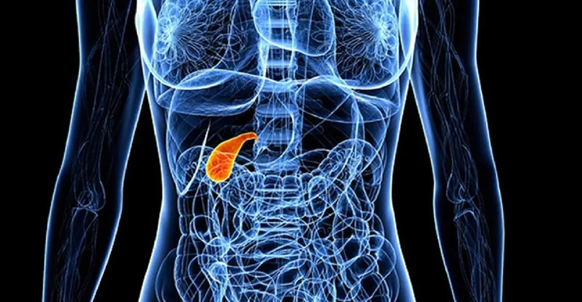 این علائم نشانه ابتلاء به سرطان کیسه صفرا است