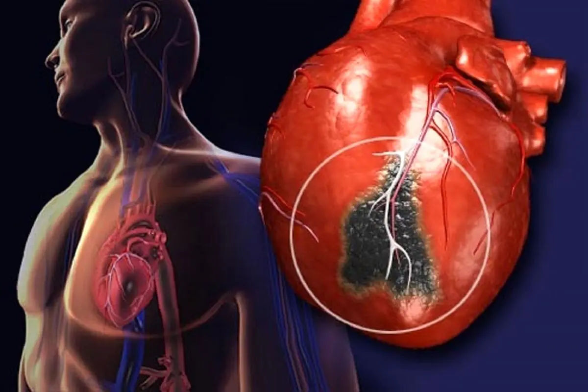 نشانه‌های مخفی حملات قلبی کدامند؟