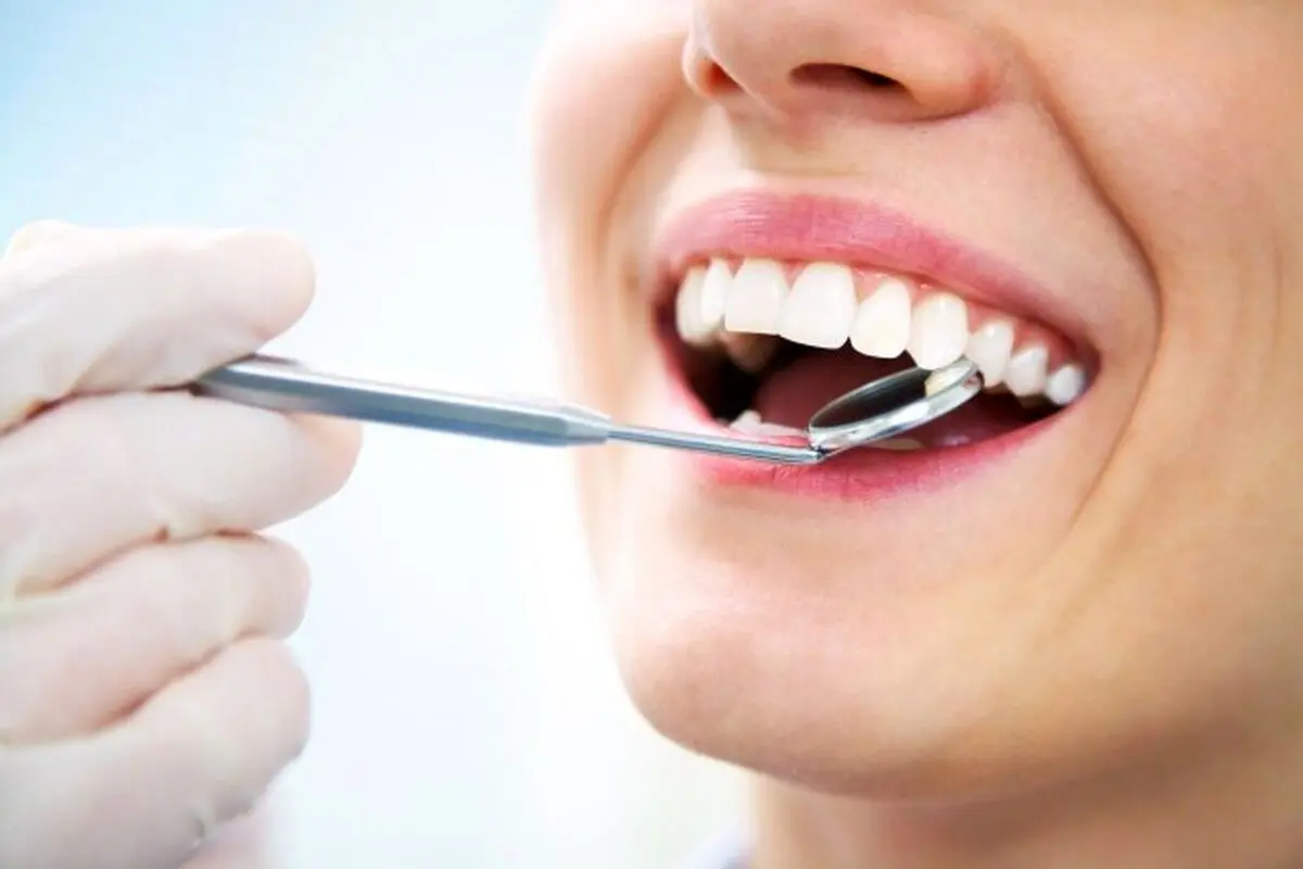 درمان زردی دندان با روش های شگفت انگیز