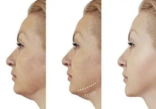 آموزش ساخت ماسک آبرسان عسل و آلوئه‌ورا