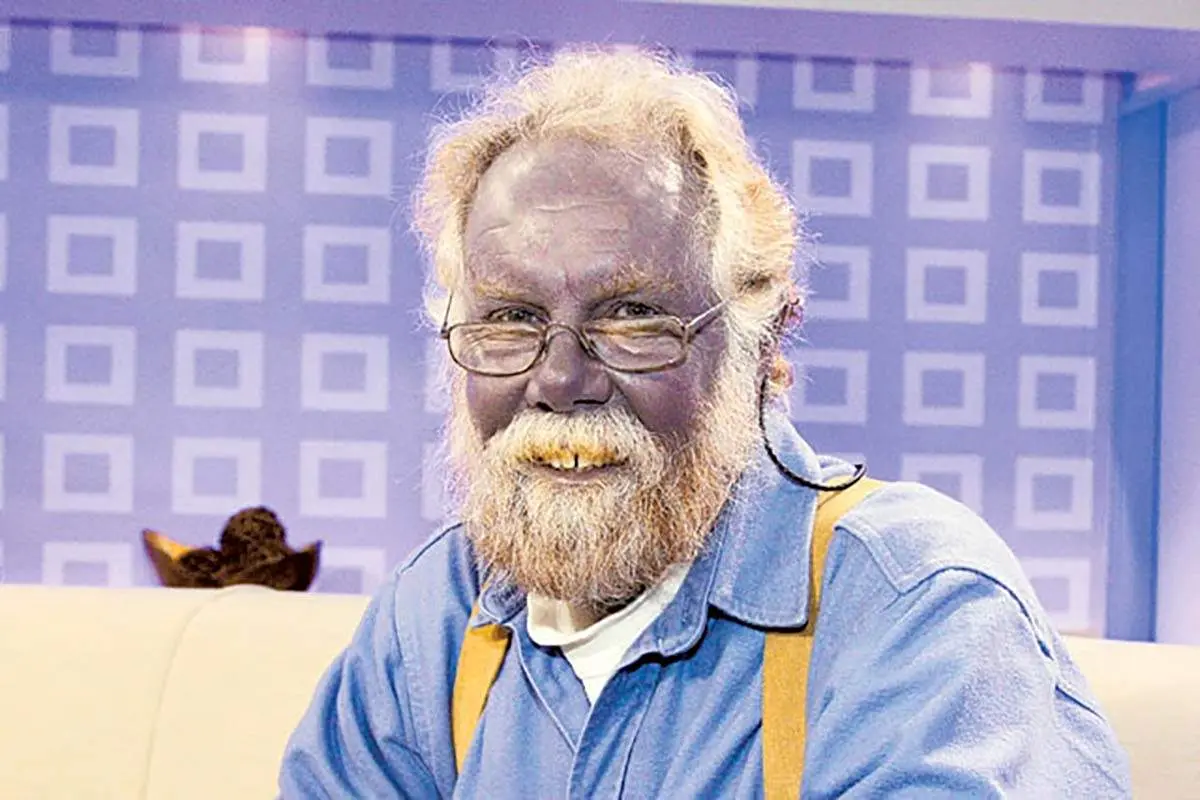 پوست آبی رنگ این مرد عجیب همه را شگفت زده کرد+ تصاویر