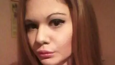 نترسید! این زن با تزریق ژل به لب‌هایش می خواهد رکورد گینس را بشکند!