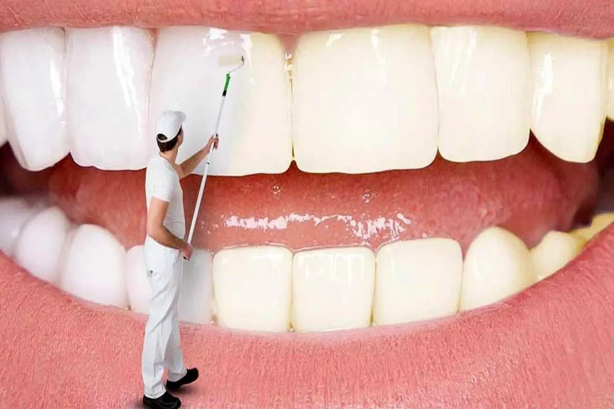 راه حل سه سوته برای سفید شدن دندان ها