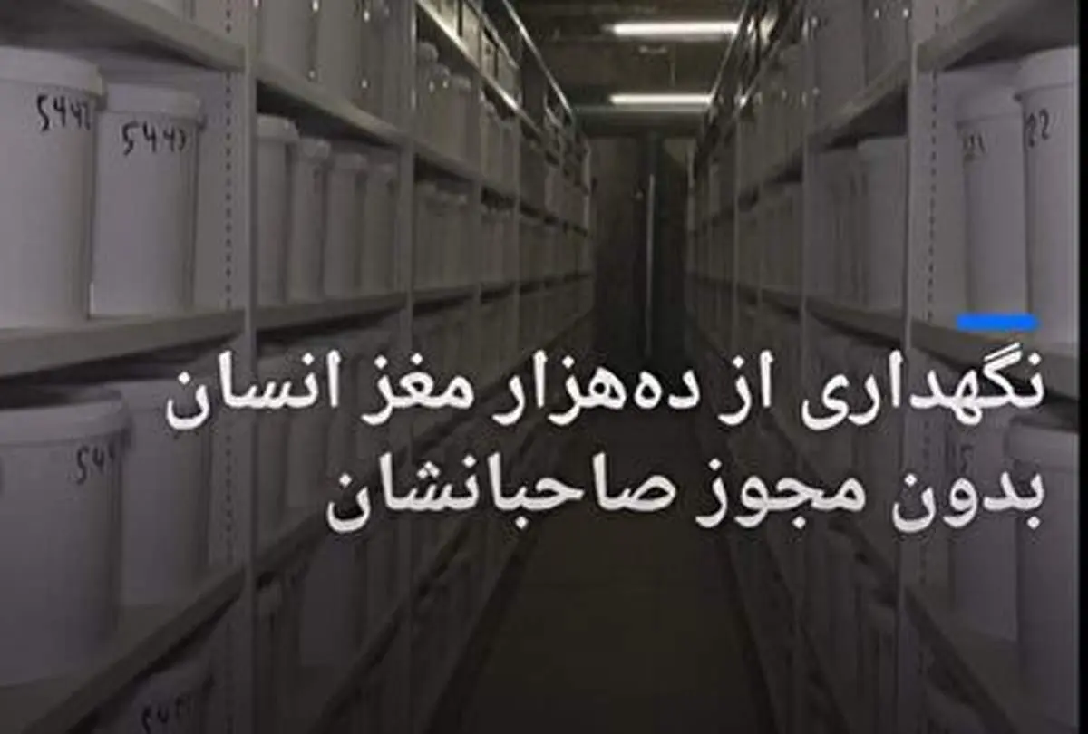 تصاویر دلهره‌ آور از مرکز نگهداری مغز در دانمارک!