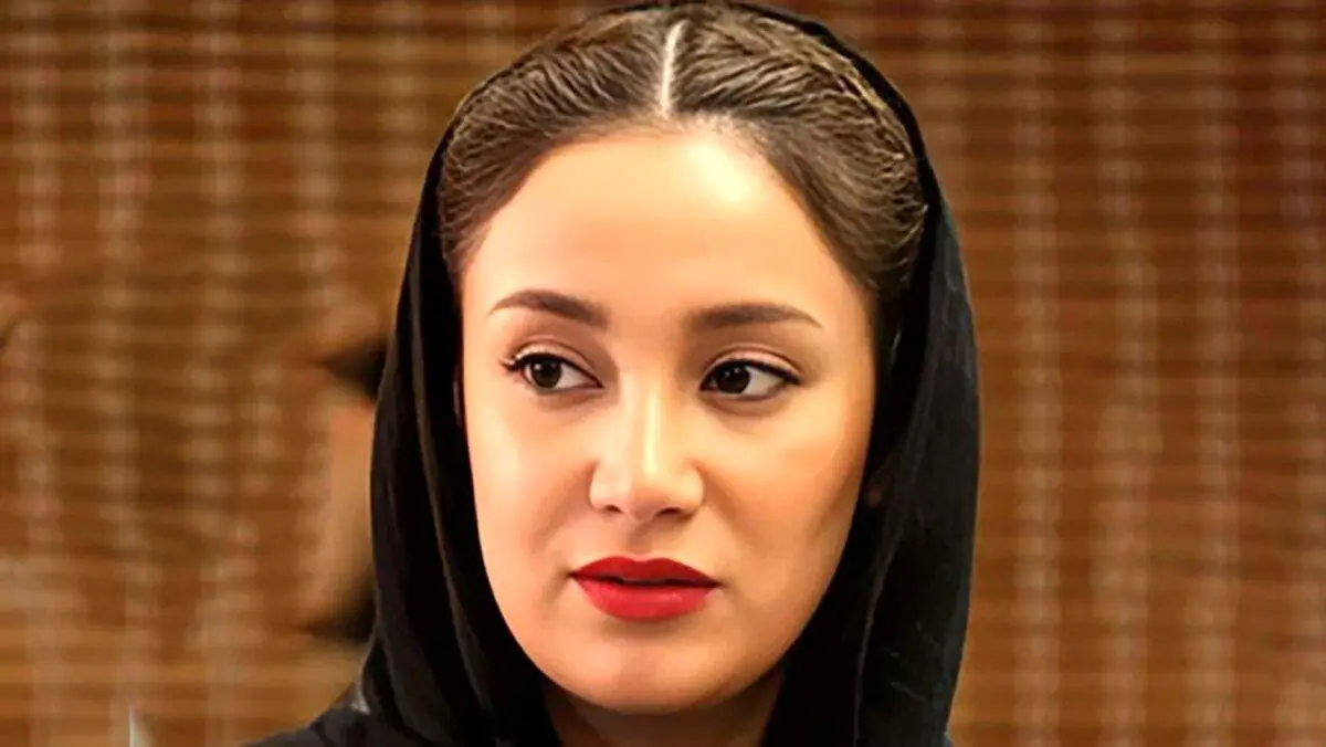 رونمایی بهاره افشار از استایل جدیدش بعد عمل زیبایی + عکس