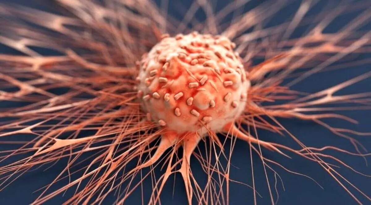 این سرطان قاتل مردان ایرانی است