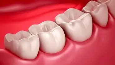 برای تسکین فوری دندان درد چه کنیم؟