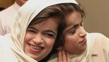 عکسی از لاله و لادن، دوقلو‌های بهم چسبیده معروف در کنکور ۱۳۷۲