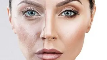 از معجزه چای سیاه بر روی پوست غافل نشوید