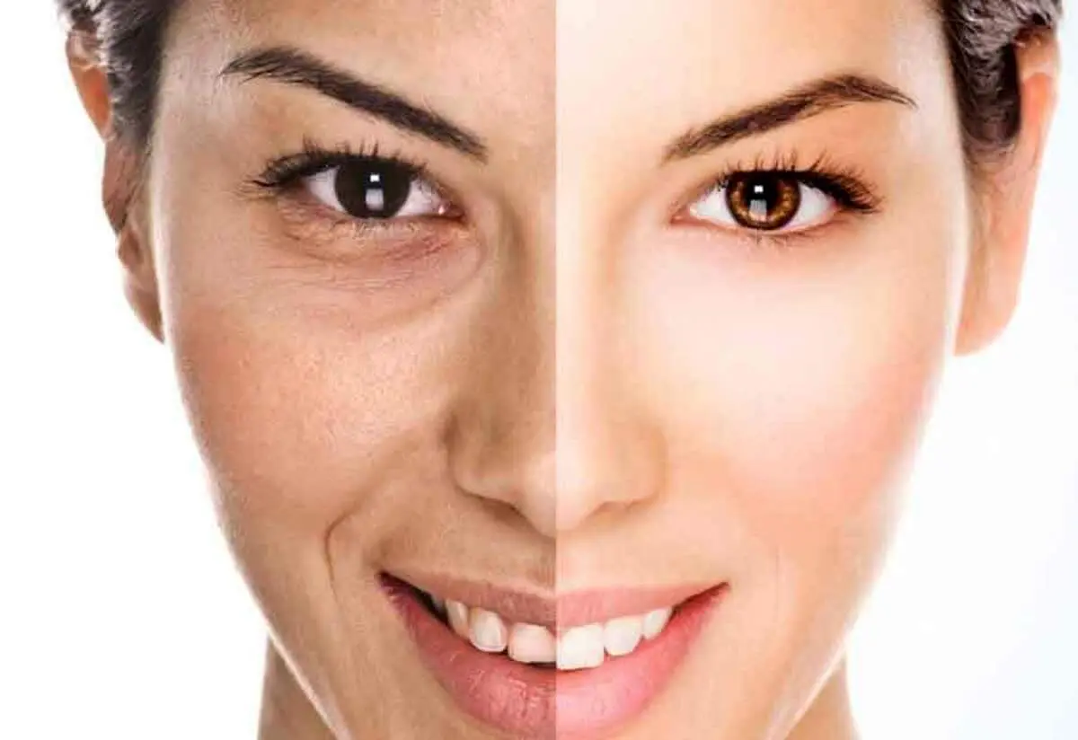 دستگاه کربوکسی چیست؟ چه کاربردی در زیبایی دارد؟