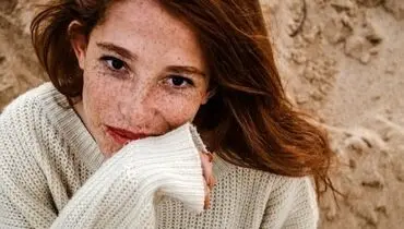 برای درمان لک های آفتاب سوختگی چه کنیم؟