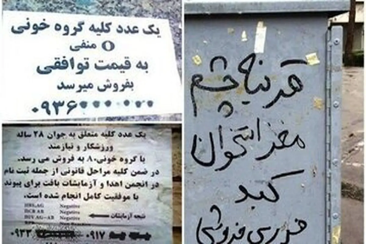 عراقی‌ها خریدار «اعضای بدن» ایرانیان به قیمت دلار!