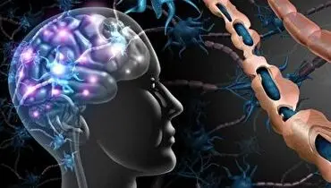 خبر خوش برای بیماران ام اس در ایران + فیلم