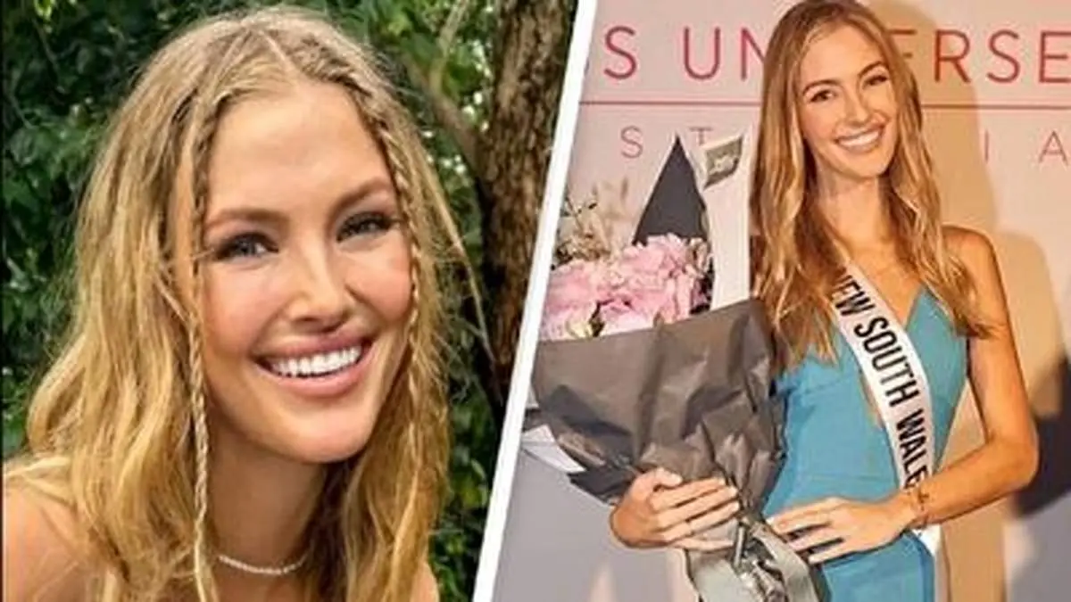 فینالیست Miss Universe در سانحه اسب سواری جان باخت+ فیلم