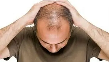 برای درمان ریزش موی سر در مردان چه کنیم؟