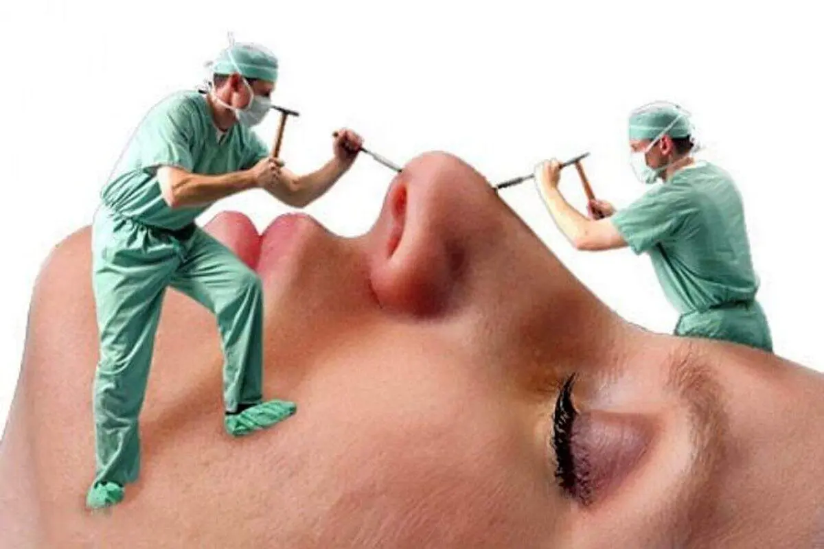 سن مناسب برای عمل زیبایی بینی