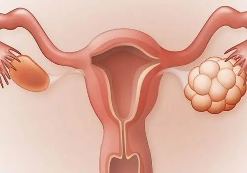 با انتخاب یکی از این ورزش ها با تنبلی تخمدان خداحافظی کنید