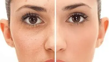 با بهترین‌ خوراکی‌ برای انواع پوست آشنا شوید