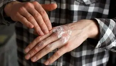 ظهور این بیماری پوستی در بازه زمانی ۲۰ تا ۵۰ سالگی