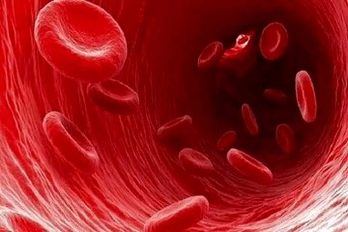 با این روش کم خونی را تشخیص دهید