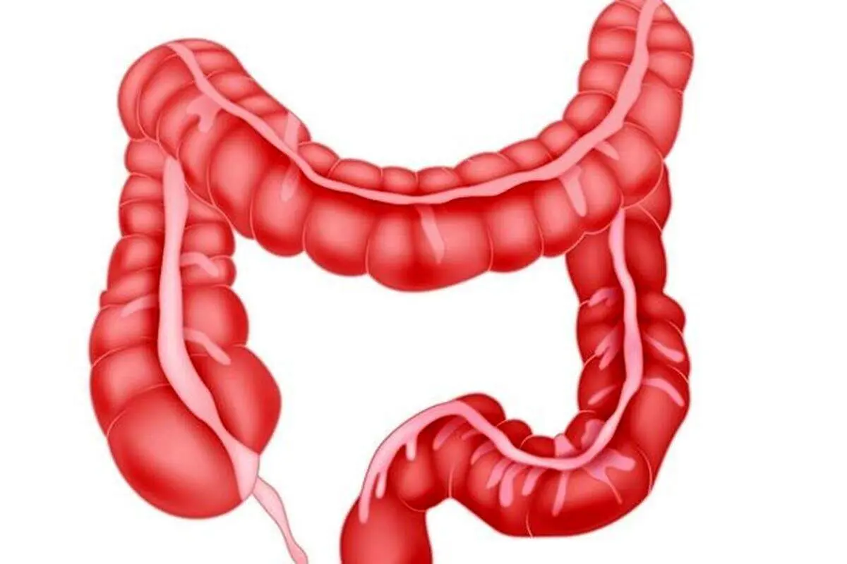 ۴ راهکار مفید برای بهبود سلامت روده+ اینفوگرافیک
