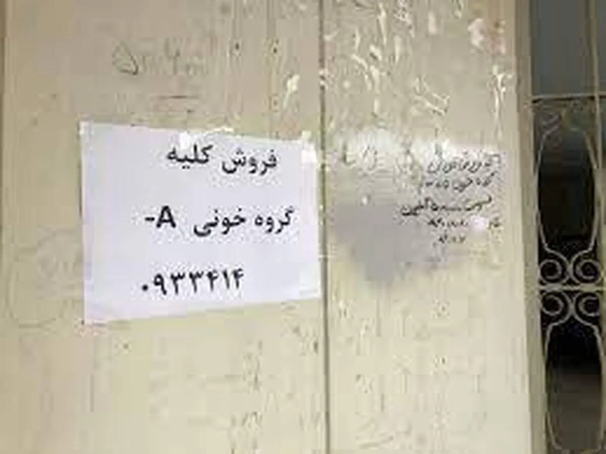 فروش کلیه برای رهن خانه و خرید ماشین!
