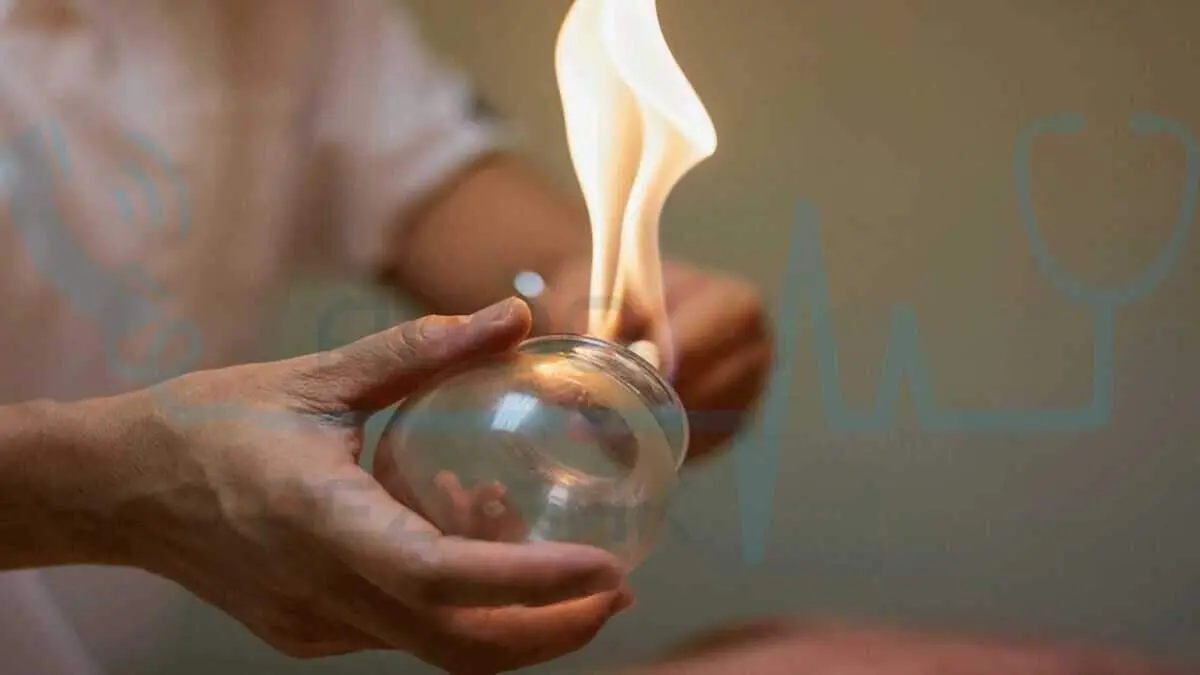 آشنایی با عوارض ممکن حجامت