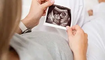 اتفاقی بسیار نادر در بارداری یک زن آمریکایی