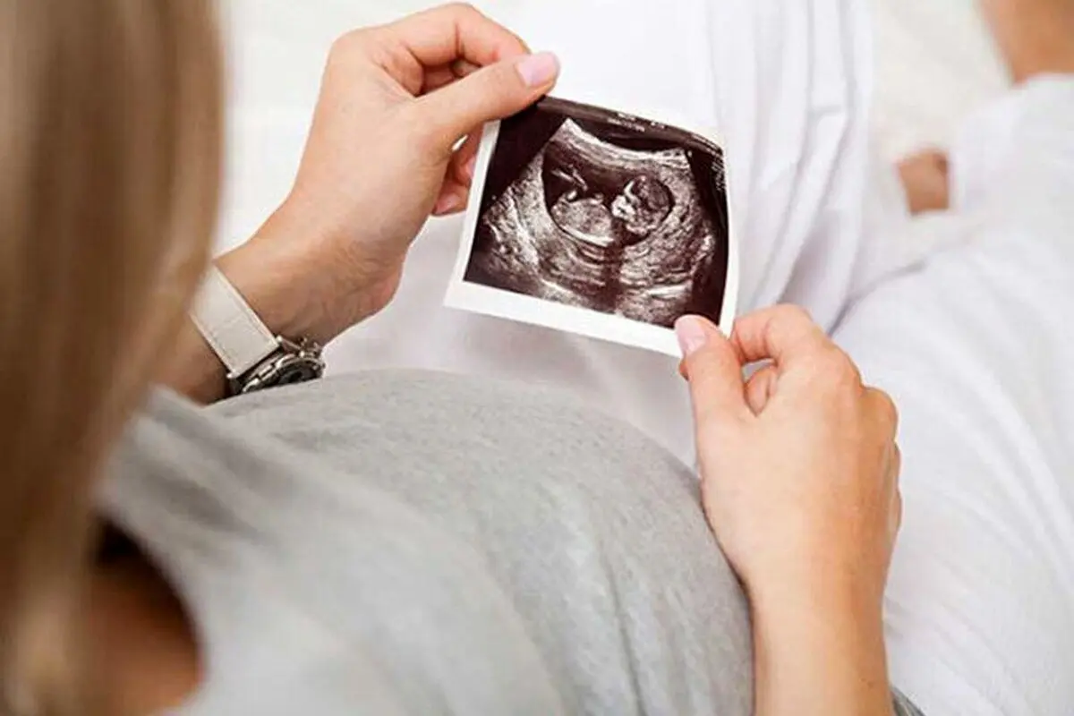 اتفاقی بسیار نادر در بارداری یک زن آمریکایی