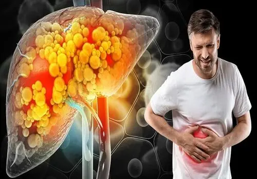 اثربخشی حرکت ورزشی خاص بر روی متابولیسم بیماری‌های کبد
