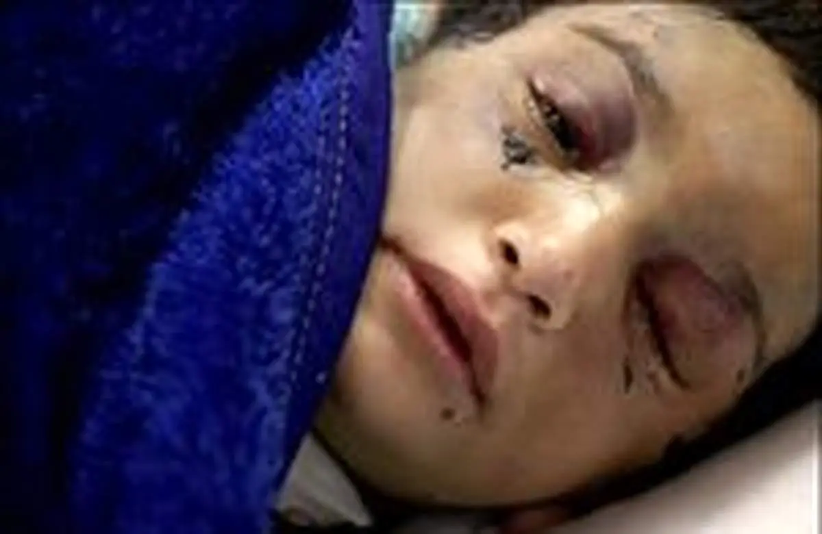 مجازات "کودک آزاری جنسی" در قوانین ایران چیست؟