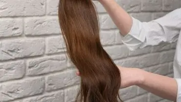 پروتز مو چیست؟/انواع پروتز مو