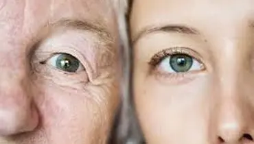 ثبت اختراع بین المللی ماده Decode کننده ژنهای پوست توسط یک پزشک ایرانی