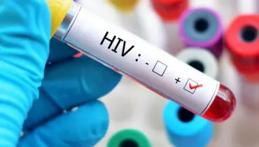 نجات هفتمین بیمار از HIV