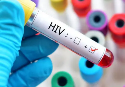 بیشترین شیوع HIV در این بازه سنی