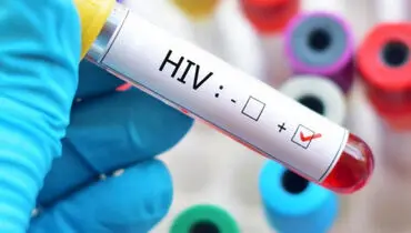 نجات هفتمین بیمار از HIV