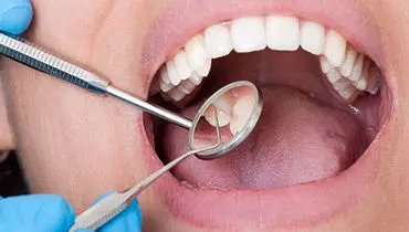 چگونه بیماری‌های دهان بر عملکرد مغز اثر می‌گذارند؟