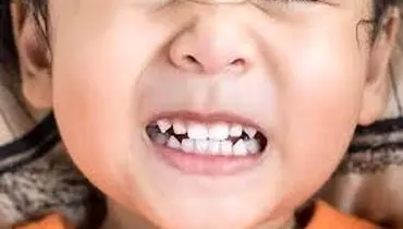 دندان‌قروچه در خواب نشانه چیست؟
