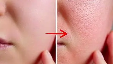 راز پوست شفاف و بدن سالم در یک میوه تابستانی: خربزه را دست‌کم نگیرید!
