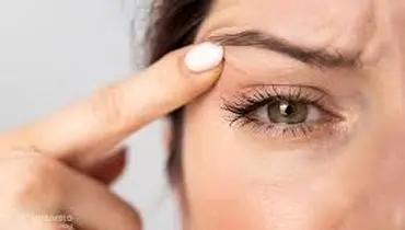 پریدن مکرر پلک؛ چه زمانی می‌تواند زنگ خطر سلامتی باشد؟