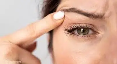 پریدن مکرر پلک؛ چه زمانی می‌تواند زنگ خطر سلامتی باشد؟