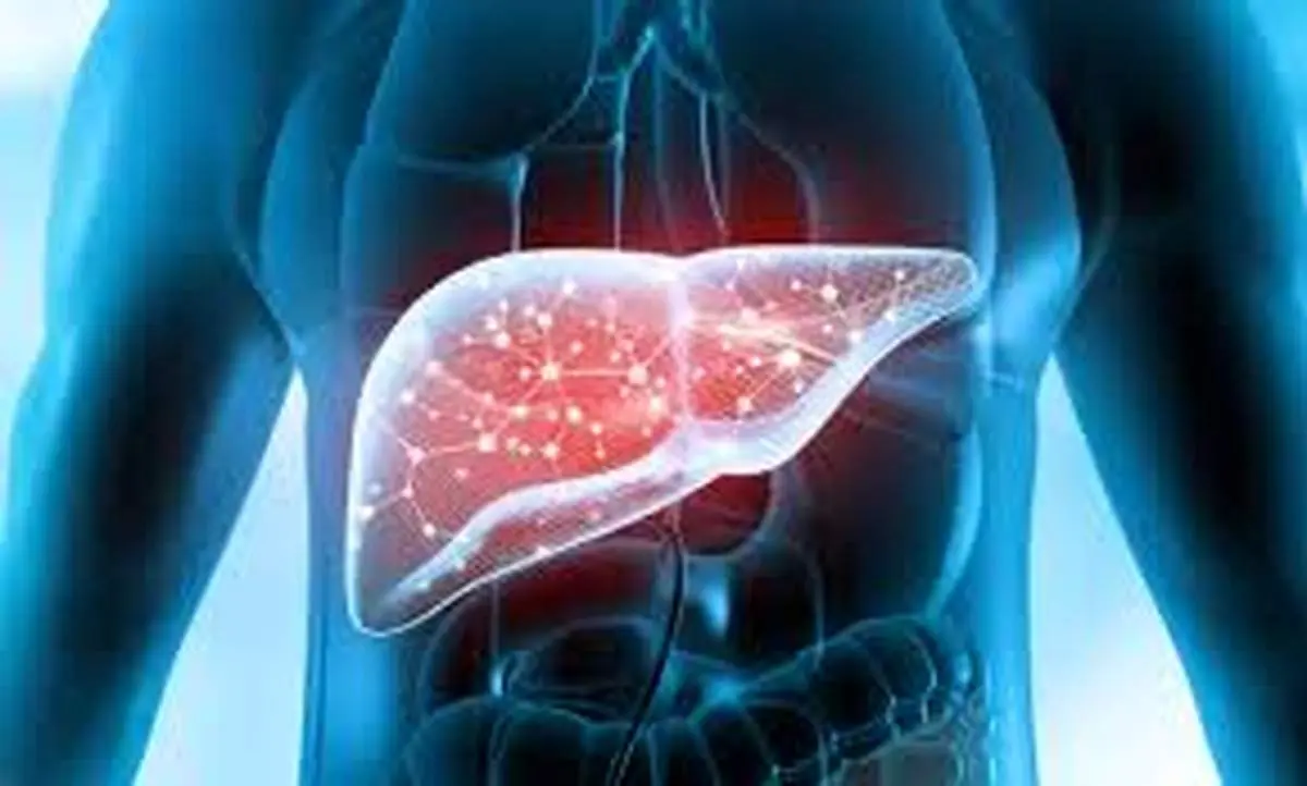 ۷ باور غلط درباره کبد چرب که درمان را به تأخیر می اندازد!
