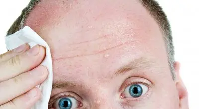 عرق کردن بیش از حد نشانه چیست؟