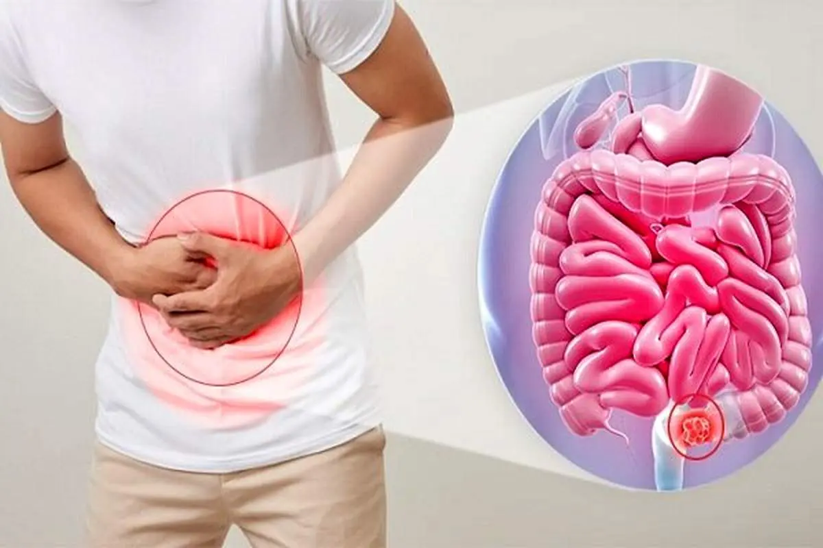 عوارض بهموقع تخلیه نکردن روده چیست؟