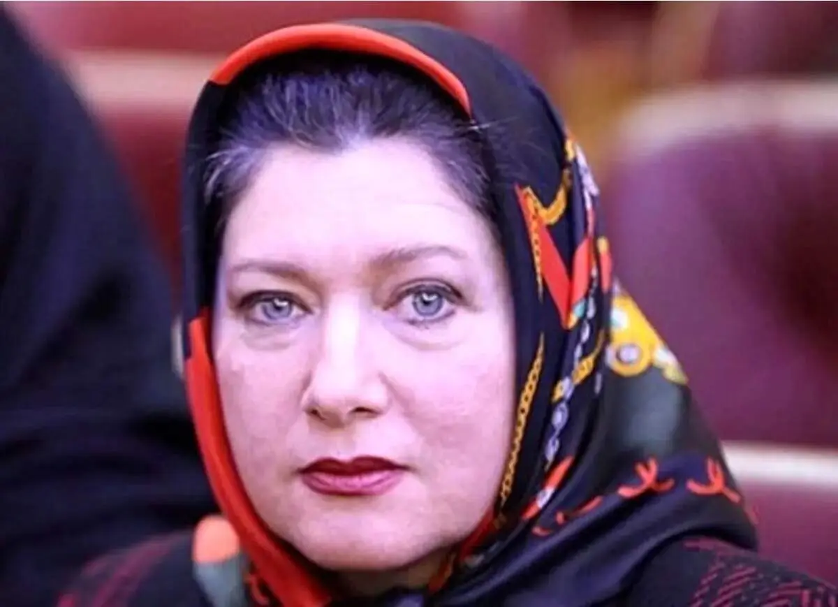 چهره جذاب فربیا متخصص در ۵۵ سالگی