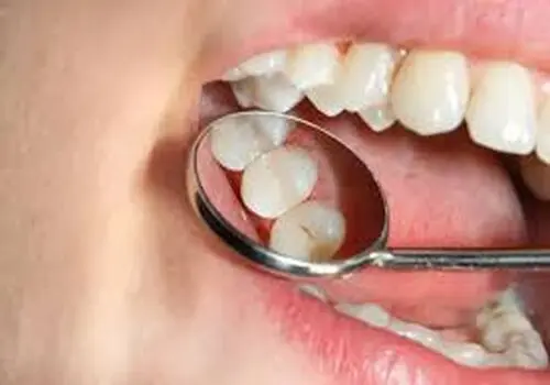  خواص دارچین برای سرماخوردگی و آنفولانزا